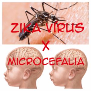 microcefalia-e-zika