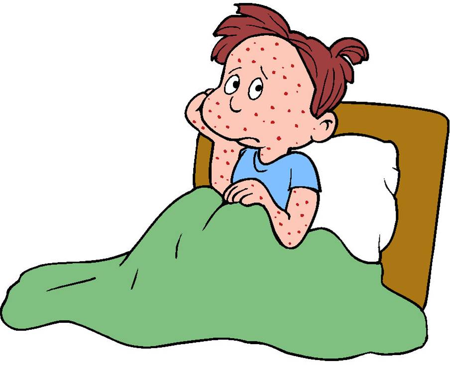 curare-la-varicella